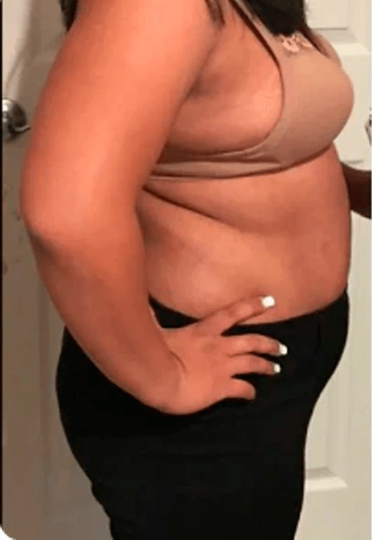 Before image